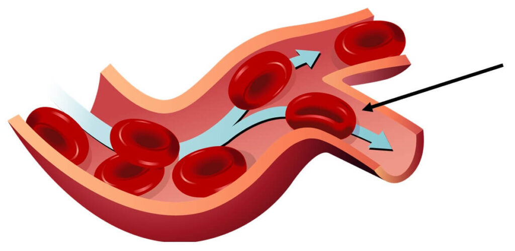 The flexible RBC membrane is made of specialized proteins such as spectrin. This allows the RBCs to fit into tight spots as it flows in the bloodstream.