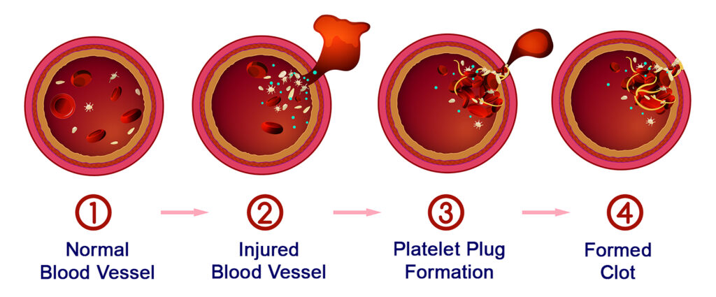 Blood clotting process. One of the important roles that platelets play is being involved in the stopping of blood flow in open wounds.
