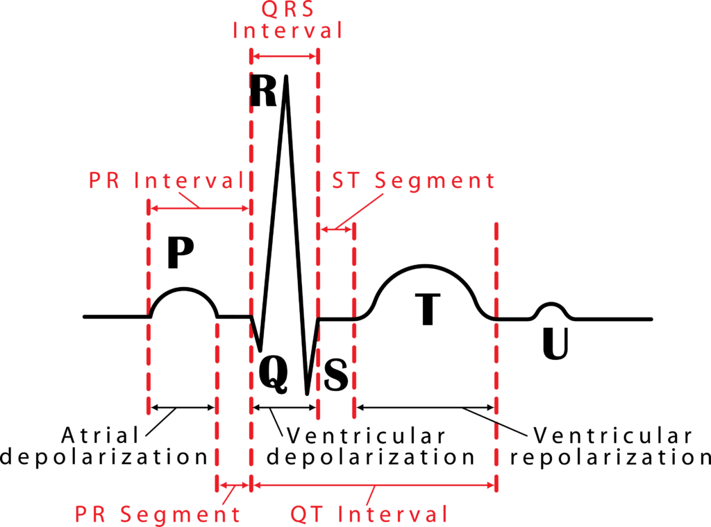 Electrocardiogram waveform labeled