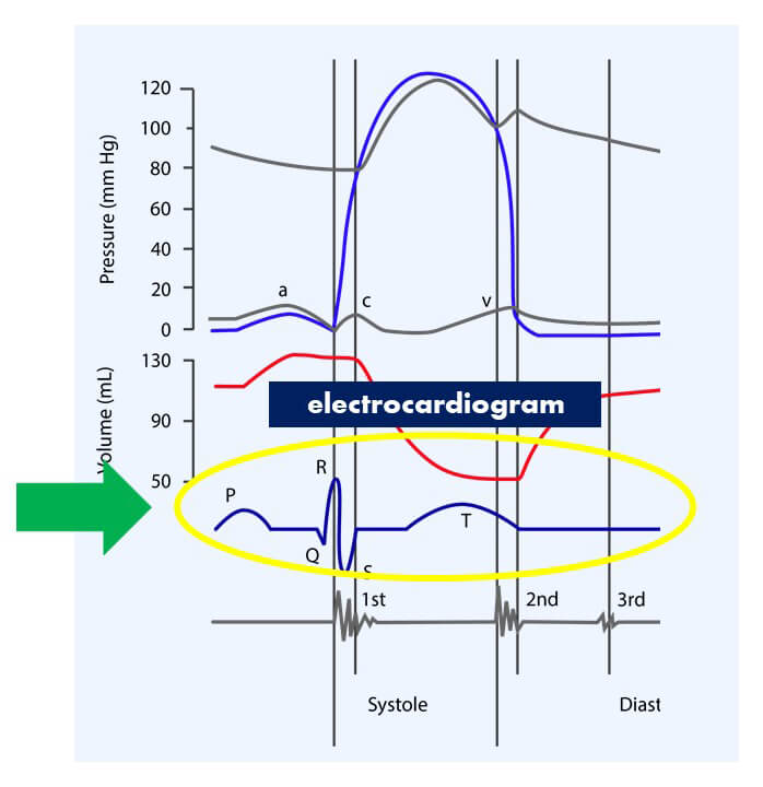 Electrocardiogram highlighted in the diagram.